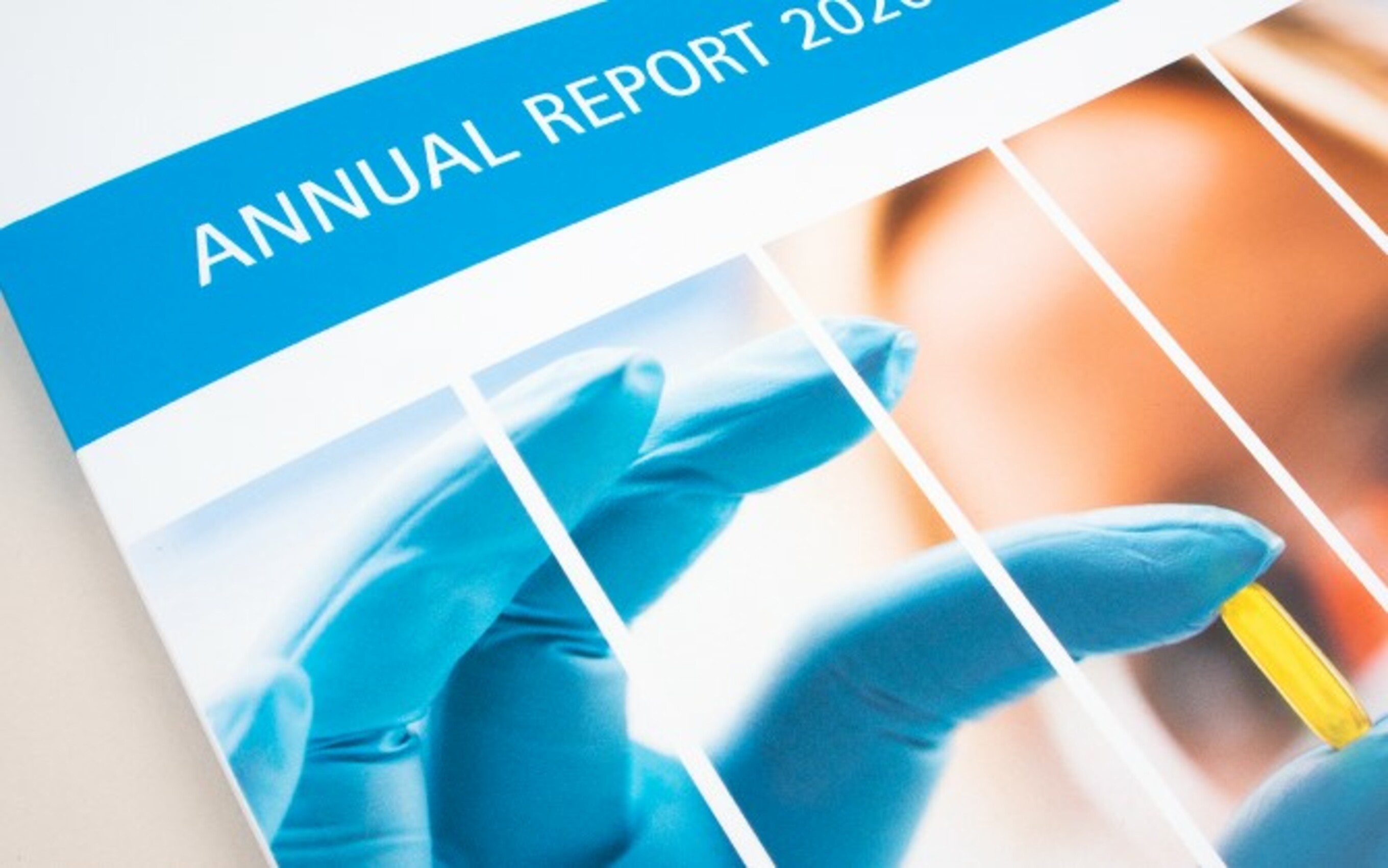 Geschäftsbericht ducken lassen